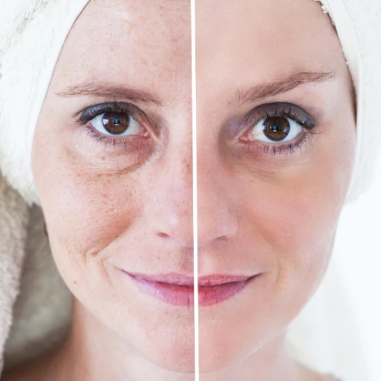 Jak zwalczyć skutki fotostarzenia skóry i cieszyć się młodszym wyglądem?