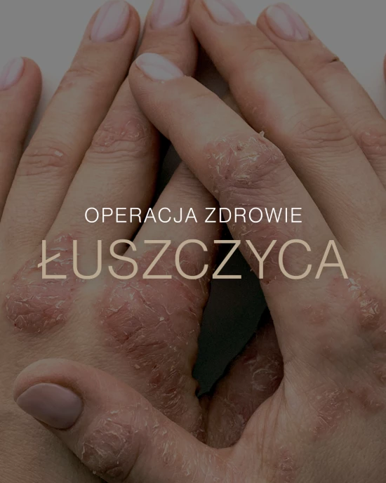 „Operacja zdrowie” – odc. 24: Jak skutecznie walczyć z łuszczycą? Historie pacjentów