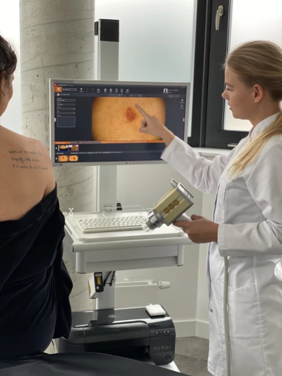 Wideodermatoskopia – badanie znamion i pieprzyków | Klinika Ambroziak