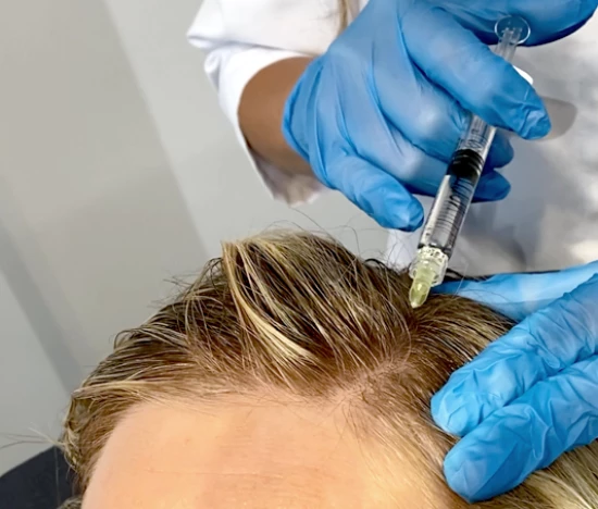 Mezoterapia peptydowa – zastrzyki na porost włosów | Klinika Ambroziak
