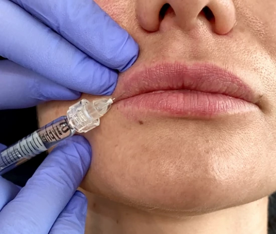 Zabieg nawilżającej mezoterapii ust: cena i efekty | Klinika Ambroziak